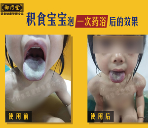 御療堂藥浴積食寶寶對比舌苔2